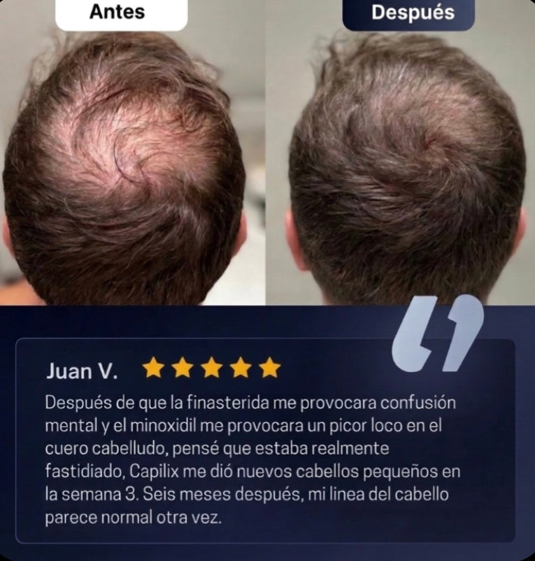 Capilix Serum Roll-On para el Crecimiento del Cabello